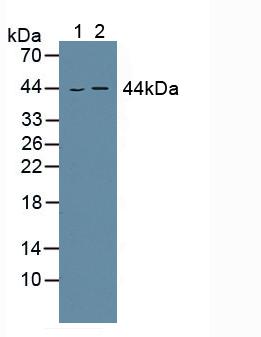 Polyclonal Antibody to Aspartate Aminotransferase (AST)