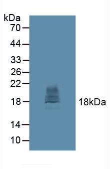 Polyclonal Antibody to Cytotoxic T-Lymphocyte Associated Antigen 4 (CTLA4)