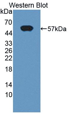 Polyclonal Antibody to Chymotrypsin C (CTRC)