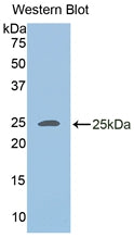 Polyclonal Antibody to Adipose Differentiation Related Protein (ADRP)