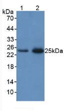 Polyclonal Antibody to Neutrophil gelatinase-associated lipocalin (NGAL)