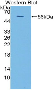 Polyclonal Antibody to Fc Fragment Of IgA Receptor (FcaR)
