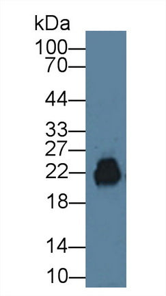 Polyclonal Antibody to Cluster Of Differentiation 99 (CD99)