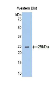 Polyclonal Antibody to Acetylcholinesterase (ACHE)