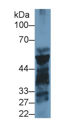 Polyclonal Antibody to Pancreatic Lipase (PL)