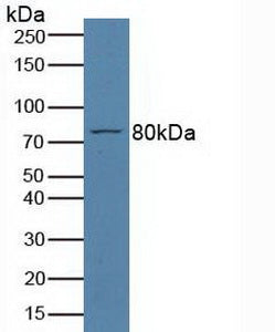 Polyclonal Antibody to Thrombopoietin Receptor (TPOR)