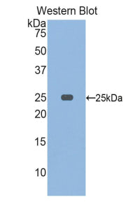 Polyclonal Antibody to Osteoclast Stimulating Factor 1 (OSF)