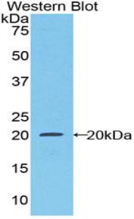 Polyclonal Antibody to Colony Stimulating Factor Receptor, Macrophage (MCSFR)