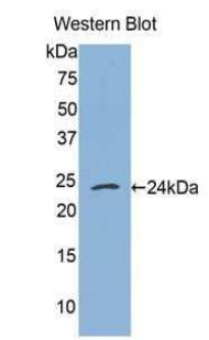 Polyclonal Antibody to Tumor Necrosis Factor Receptor 1 (TNFR1)