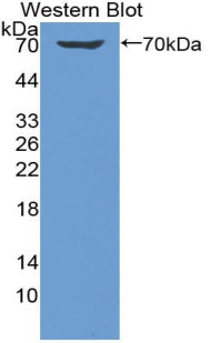 Polyclonal Antibody to Killer Cell Immunoglobulin Like Receptor 2DL1 (KIR2DL1)