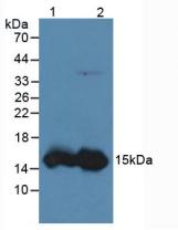 Polyclonal Antibody to Fatty Acid Binding Protein 1 (FABP1)