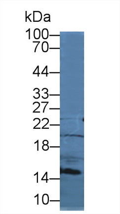 Polyclonal Antibody to Secondary Lymphoid Tissue Chemokine (SLC)