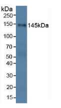 Polyclonal Antibody to Palladin (PALLD)