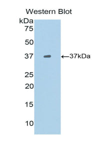 Polyclonal Antibody to B-Lymphocyte Chemoattractant 1 (BLC1)