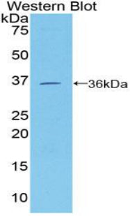 Polyclonal Antibody to Cluster Of Differentiation 146 (CD146)