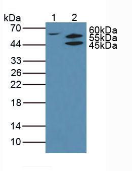 Polyclonal Antibody to Protein Kinase B Beta (PKBb)