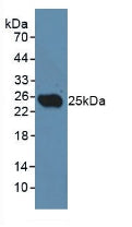 Polyclonal Antibody to Cluster Of differentiation 301 (CD301)