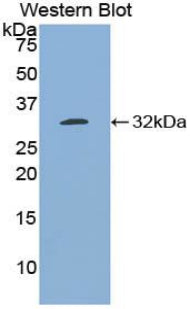 Polyclonal Antibody to B-Cell CLL/Lymphoma 3 (Bcl3)
