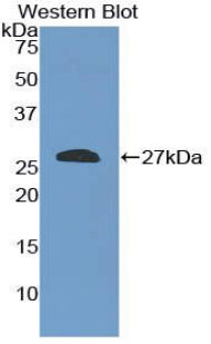 Polyclonal Antibody to SHC-Transforming Protein 2 (SHC2)