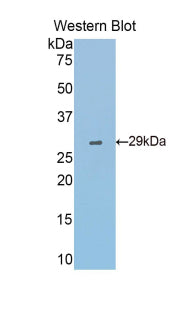 Polyclonal Antibody to Fascin (FSCN)