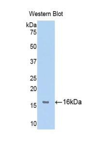 Polyclonal Antibody to Fibroblast Growth Factor Receptor 1 (FGFR1)