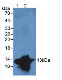 Polyclonal Antibody to S100 Calcium Binding Protein A9 (S100A9)