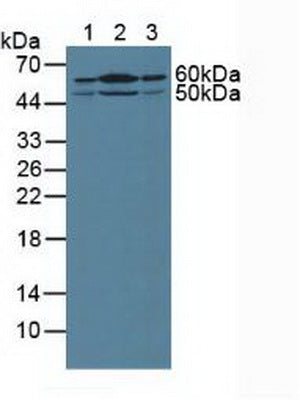 Polyclonal Antibody to Hedgehog Homolog, Sonic (SHH)