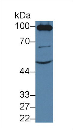 Polyclonal Antibody to Angiotensin I Converting Enzyme 2 (ACE2)