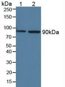 Polyclonal Antibody to Mannose Associated Serine Protease 1 (MASP1)