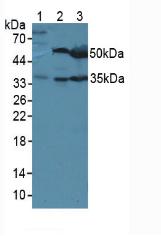Polyclonal Antibody to Leucine Rich Alpha-2-Glycoprotein 1 (LRG1)