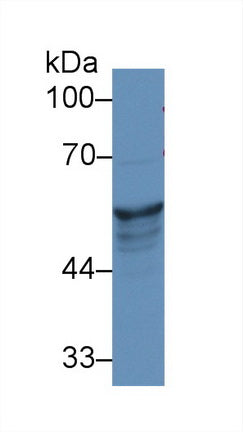 Polyclonal Antibody to Cytokeratin 8 (CK8)