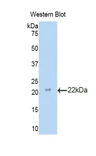 Polyclonal Antibody to Laminin Gamma 3 (LAMC3)