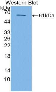 Polyclonal Antibody to Transforming Growth Factor Beta Receptor III (TGFbR3)