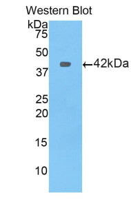 Polyclonal Antibody to Profilin 1 (PFN1)