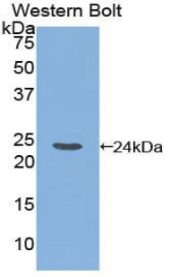 Polyclonal Antibody to Disrupted In Schizophrenia 1 (DISC1)