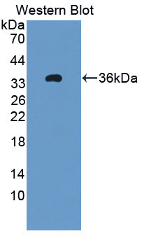 Polyclonal Antibody to 11-Beta-Hydroxysteroid Dehydrogenase Type 1 (HSD11b1)