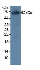 Polyclonal Antibody to Carboxylesterase 1 (CES1)