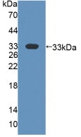 Polyclonal Antibody to Flavin Containing Monooxygenase 2, Non Functional (FMO2)