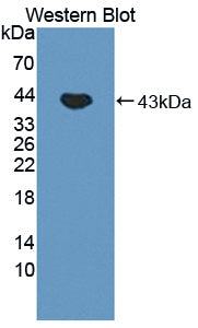 Polyclonal Antibody to Ferrochelatase (FECH)