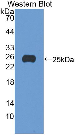 Polyclonal Antibody to Geranylgeranyl Diphosphate Synthase 1 (GGPS1)