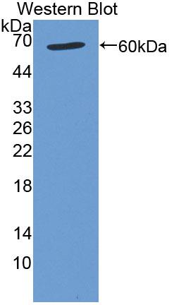 Polyclonal Antibody to General Transcription Factor IIA, Polypeptide 1 (GTF2A1)