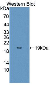 Polyclonal Antibody to Leucine Zipper, Down Regulated In Cancer 1 (LDOC1)