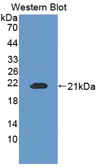 Polyclonal Antibody to Osteopetrosis Associated Transmembrane Protein 1 (OSTM1)