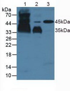 Polyclonal Antibody to Podoplanin (PDPN)