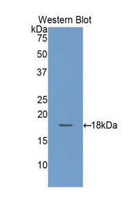 Polyclonal Antibody to Tetraspanin 3 (TSPAN3)