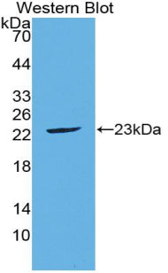 Polyclonal Antibody to Fibroblast Growth Factor 21 (FGF21)