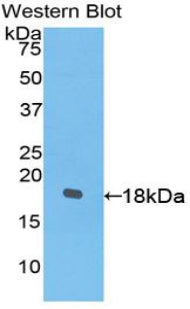 Polyclonal Antibody to Platelet Derived Growth Factor C (PDGFC)