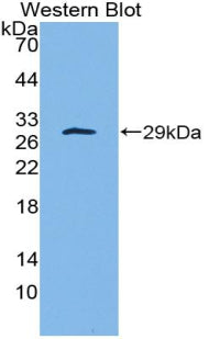 Polyclonal Antibody to Platelet Derived Growth Factor Subunit B (PDGFB)