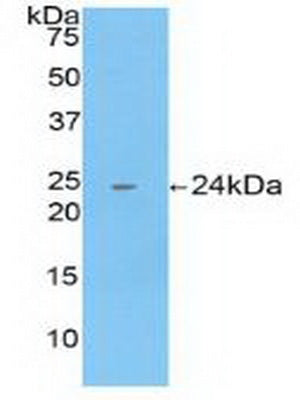 Polyclonal Antibody to Cathepsin B (CTSB)