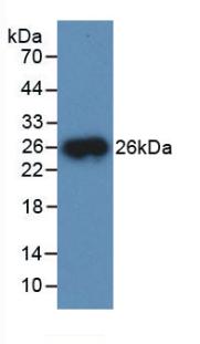 Polyclonal Antibody to Cathepsin B (CTSB)